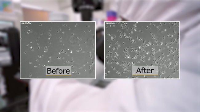 Slider image (8) HELENE  - Stem Cell Clinic